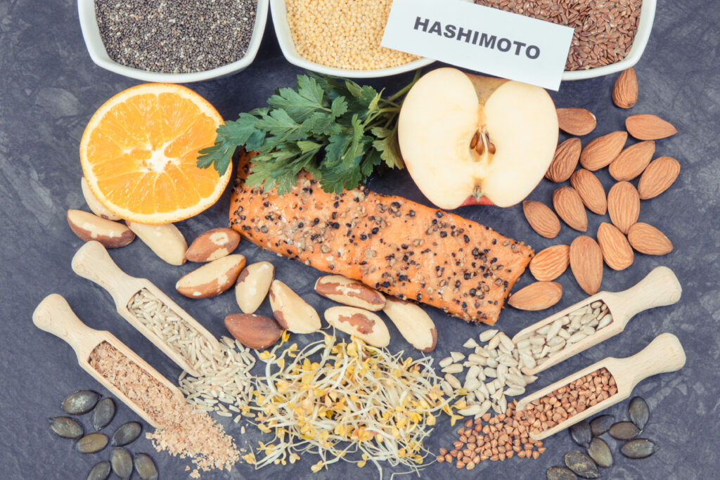Food Sources Rich in Magnesium